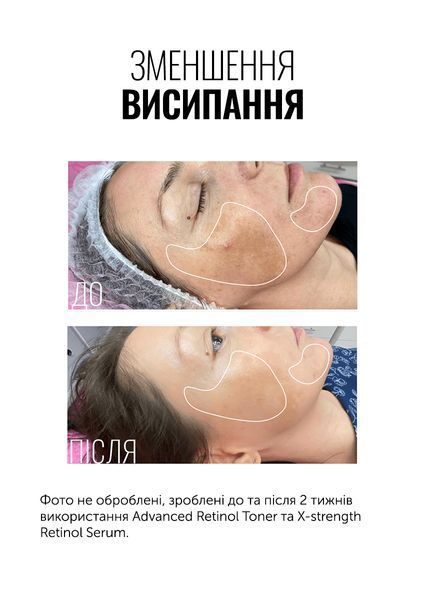 Тонер з ретинолом INSTYTUTUM Advanced Retinol Toner 150 мл 2522280935 фото