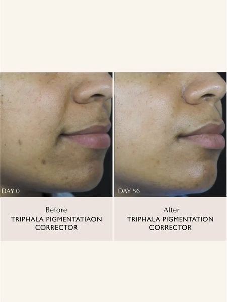 Сироватка для корекції пігментації SACHI SKIN Triphala Pigmentation Corrector 30 мл 2618304638 фото