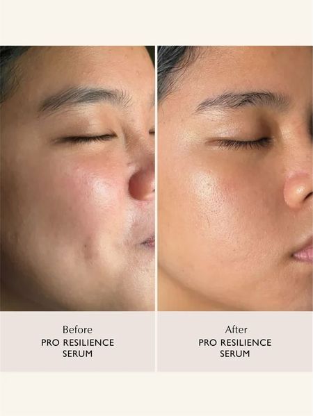 Відновлювальна сироватка для обличчя SACHI SKIN Pro Resilience Serum 30 мл 2618342839 фото