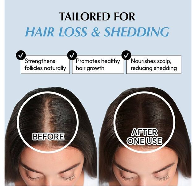 Шампунь від випадіння волосся RATED GREEN Real Grow Anti Hair Loss Treatment Shampoo 200 мл 2437835651 фото