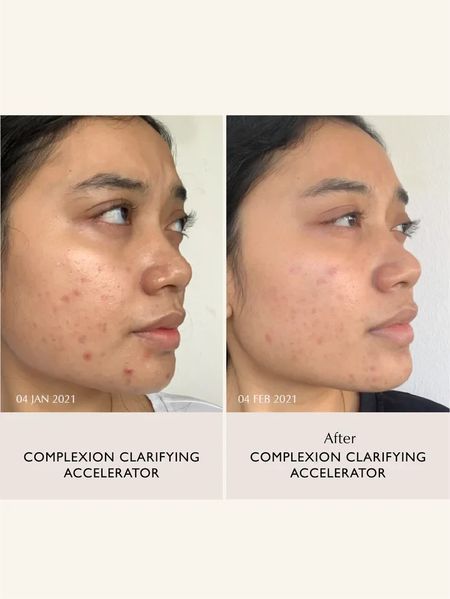 Пілінг-сироватка з ензимами та кислотами SACHI SKIN Complexion Clarifying Accelerator 30 мл 2618924173 фото