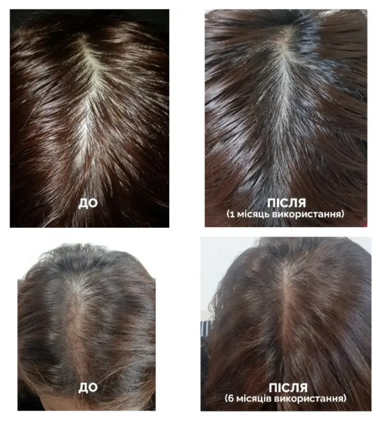 Dr.FORHAIR Folligen Shampoo - Шампунь против выпадения волос, 70 мл 2069058159 фото