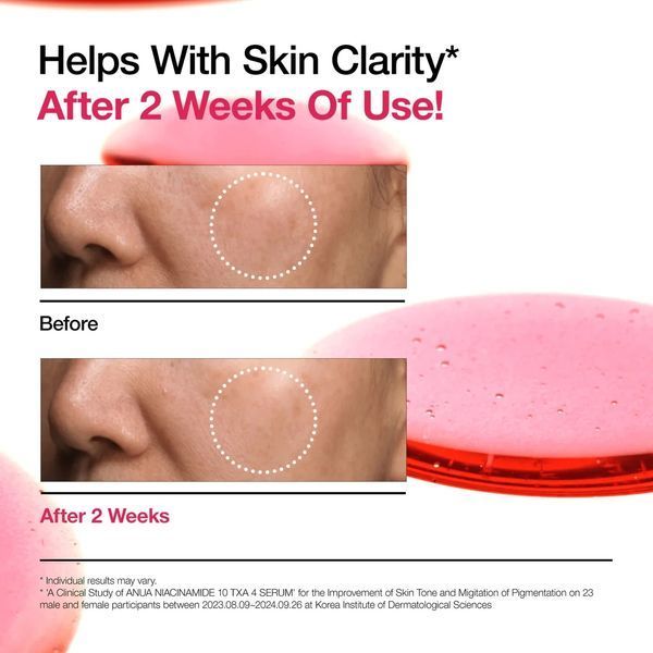 Сыворотка для лица ANUA Niacinamide 10% + TXA 4% Serum 30 мл 2590677575 фото