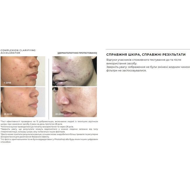 Пілінг-сироватка з ензимами та кислотами SACHI SKIN Complexion Clarifying Accelerator 30 мл 2618924173 фото