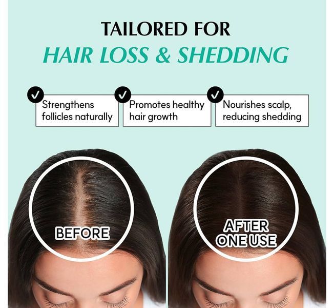 Спрей від випадіння волосся RATED GREEN Real Grow Anti-Hair Loss Stimulation Scalp Spray 120 мл 2437912876 фото