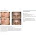 Гель-крем SACHI SKIN Ursolic Acid & Nightly Retinal Reform 30 мл з урсоловою кислотою та ретиналем