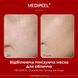 Відбілююча тонізуюча маска MEDIPEEL Glutathione Toning Tox Mask 25 мл