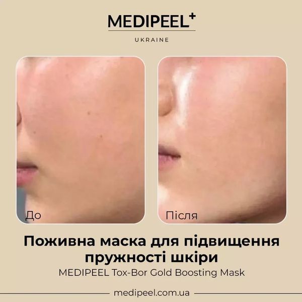 Питательная маска MEDIPEEL Tox-Bor Gold Boosting Mask 25 мл для повышения упругости кожи 2668330983 фото
