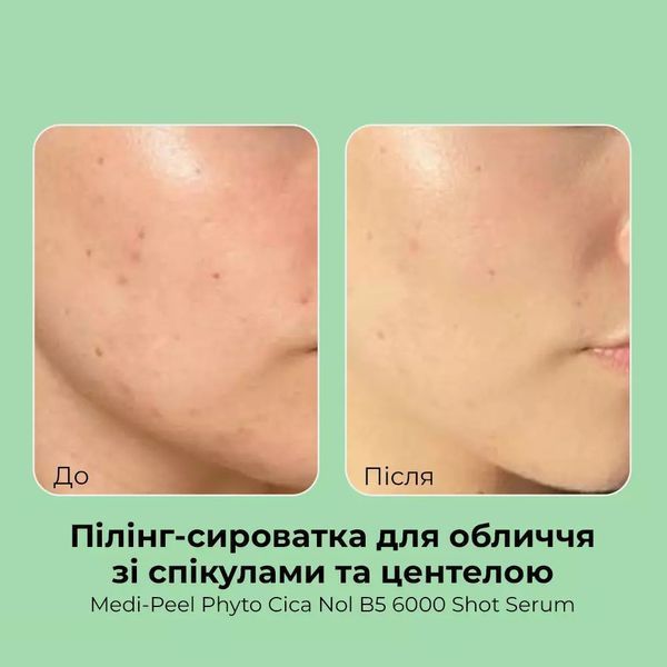 Пилинг-сыворотка для лица MEDIPEEL Phyto Cica Nol B5 6000 Shot Serum 50 мл со спикулами и центеллой 2689517304 фото