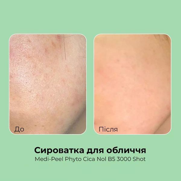 Пилинг-сыворотка со спикулами MEDIPEEL Phyto Cica Nol B5 3000 Shot Serum 50 мл 2689527511 фото