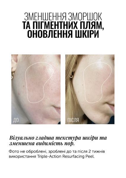 Travel size Пілінг для обличчя потрійної дії INSTYTUTUM Triple Action Resurfacing Peel 20 мл 2524409729 фото