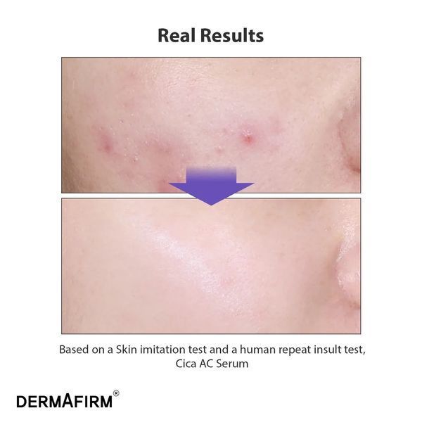 Заспокійлива сироватка DermAfirm Cicaa.C Serum 30 мл 2673108379 фото