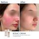 Крем з азелаїновою кислотою Braderm Rosac Cream 30 мл