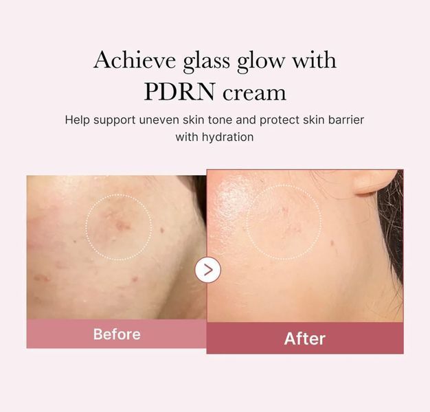 Увлажняющий крем Medicube PDRN Pink Hyaluronic Moisturizing Cream 50 мл с полинуклеотидами 2545049027 фото