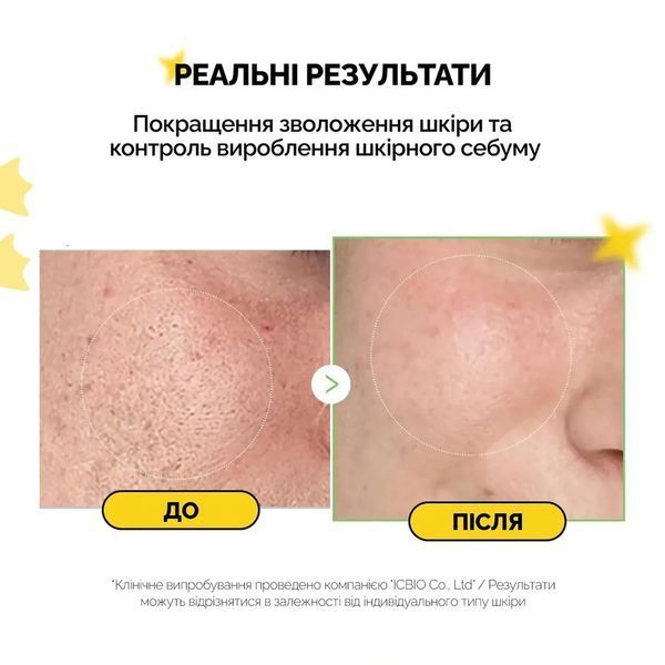 Восстанавливающий крем Medicube Exosome Cica Cream 50 мл с экзосомами центеллы и пантенолом 2676640479 фото