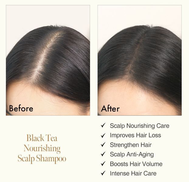 ANILLO Поживний шампунь для волосся Black Tea Nourishing Scalp Shampoo 450 мл 2482137567 фото