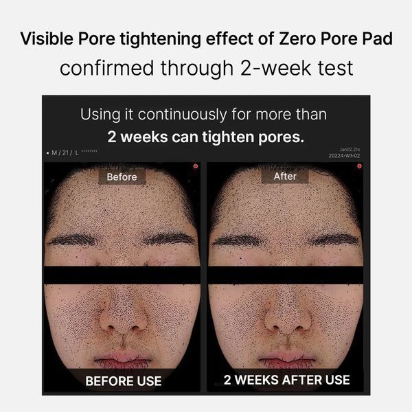 Себорегулирующий крем Medicube Zero Pore Cream 2.0 50 мл 2675664562 фото