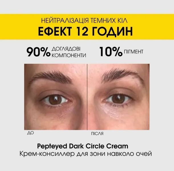 Крем-консиллер против темных кругов под глазами DermAfirm Pepteyed Dark Circle Cream 15 g 2749403104 фото