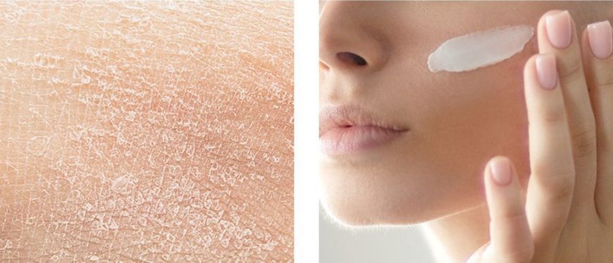 Derma Factory Skin Barrier Cream &ndash; Увлажняющий барьерный крем для лица и тела, 150 мл 1855330964 фото