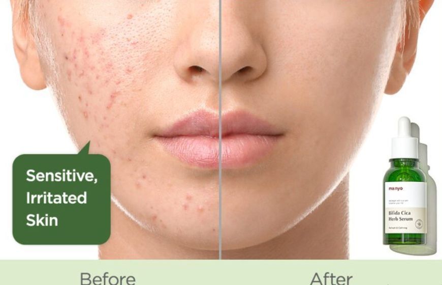 Manyo Bifida Cica Herb Serum 50 ml - Сыворотка успокаивающая с комплексом центеллы и бифидобактериями 1755269533 фото
